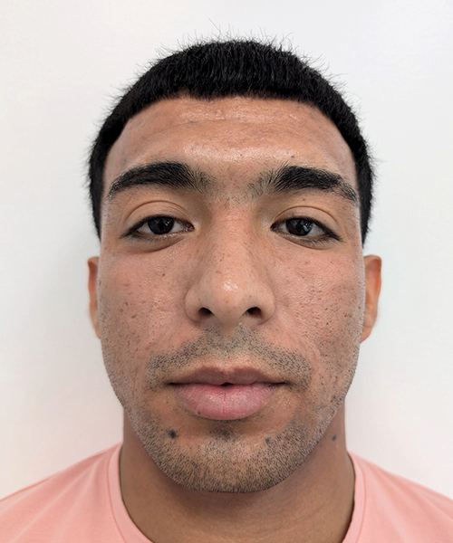 Des_Despues Des_Despues