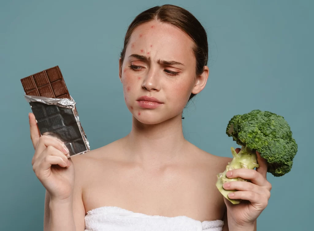 Alimentación para prevenir el acné: Guía para una piel radiante /Diet for Acne Prevention: A Guide to Radiant Skin