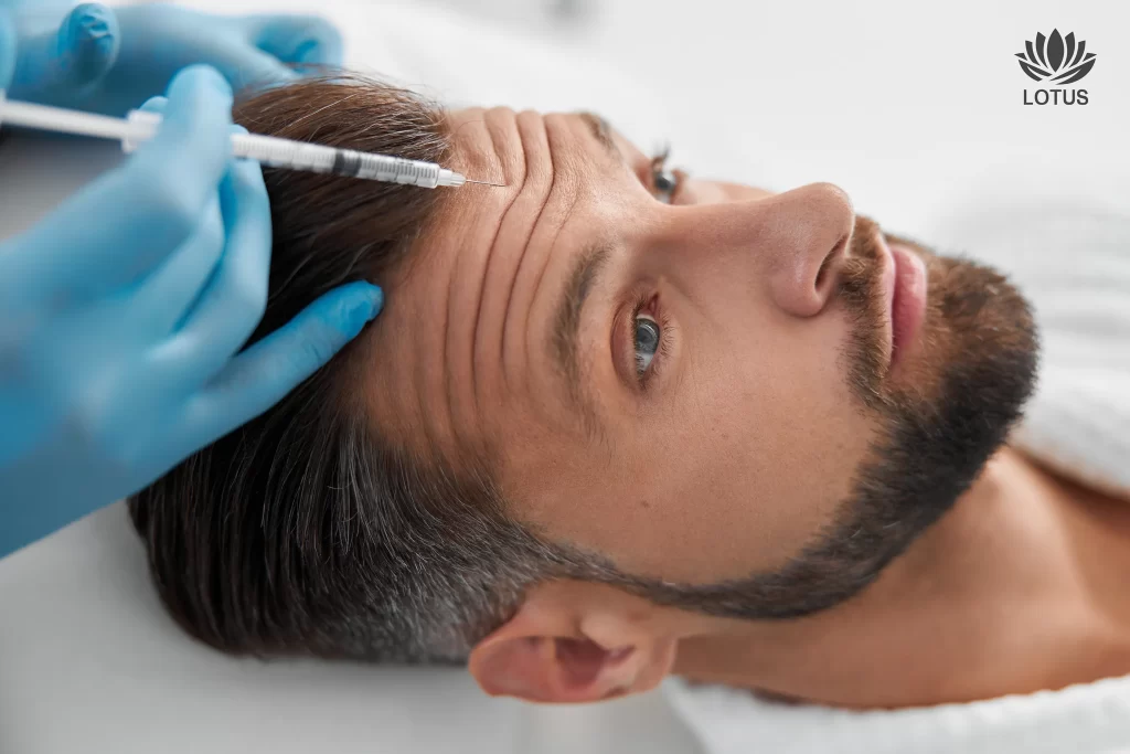 Botox en San Leandro: Resultados Naturales / Botox in San Leandro: Natural Results