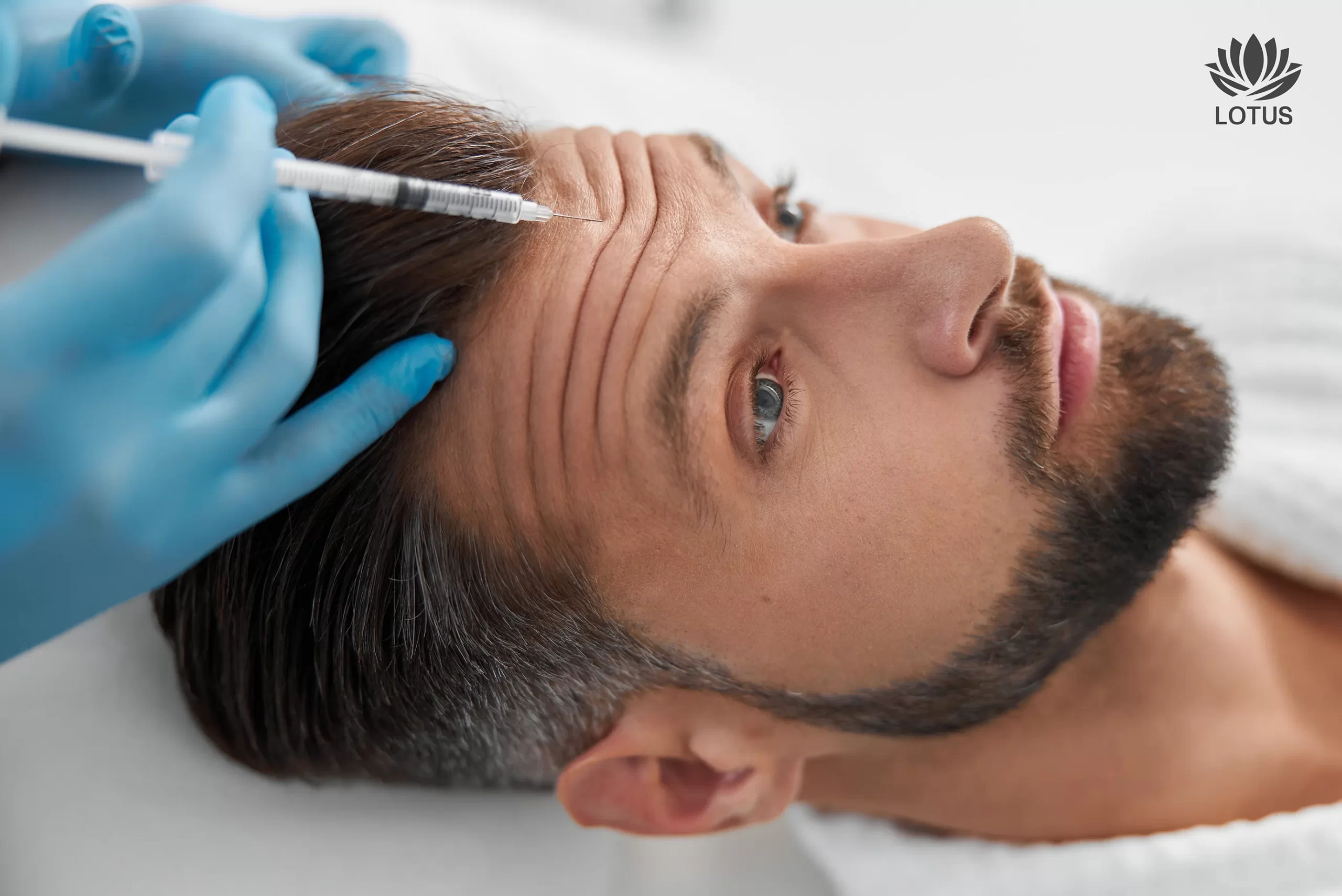 Botox en San Leandro: Resultados Naturales / Botox in San Leandro: Natural Results