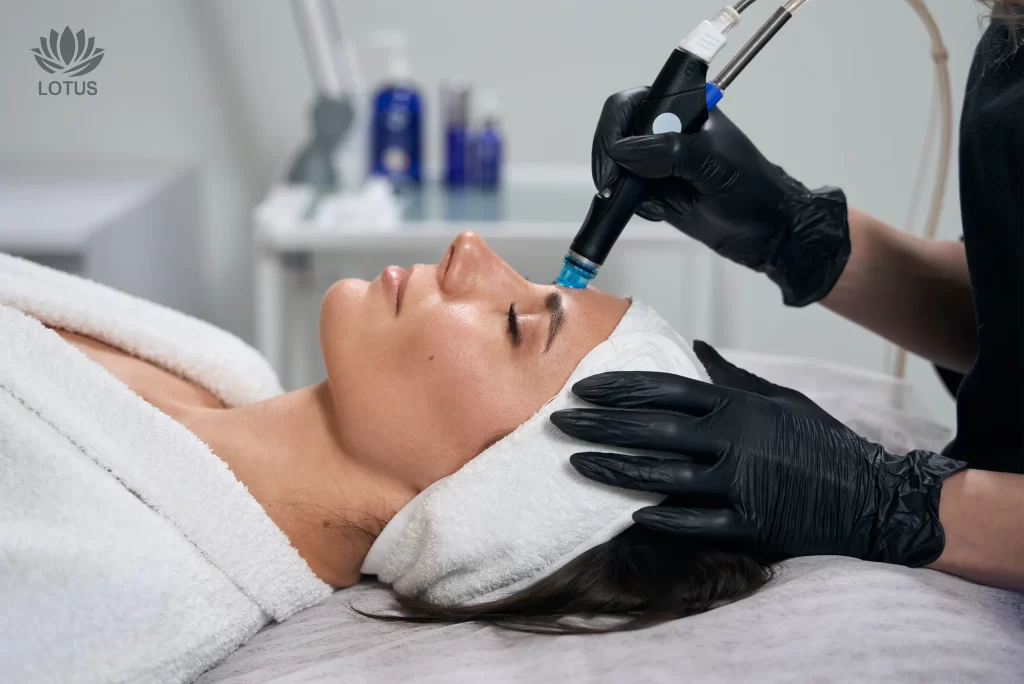 Glass Skin en San Leandro: Cómo Cerrar Poros y Alisar la Piel / Glass Skin in San Leandro: How to Tighten Pores & Smooth Skin