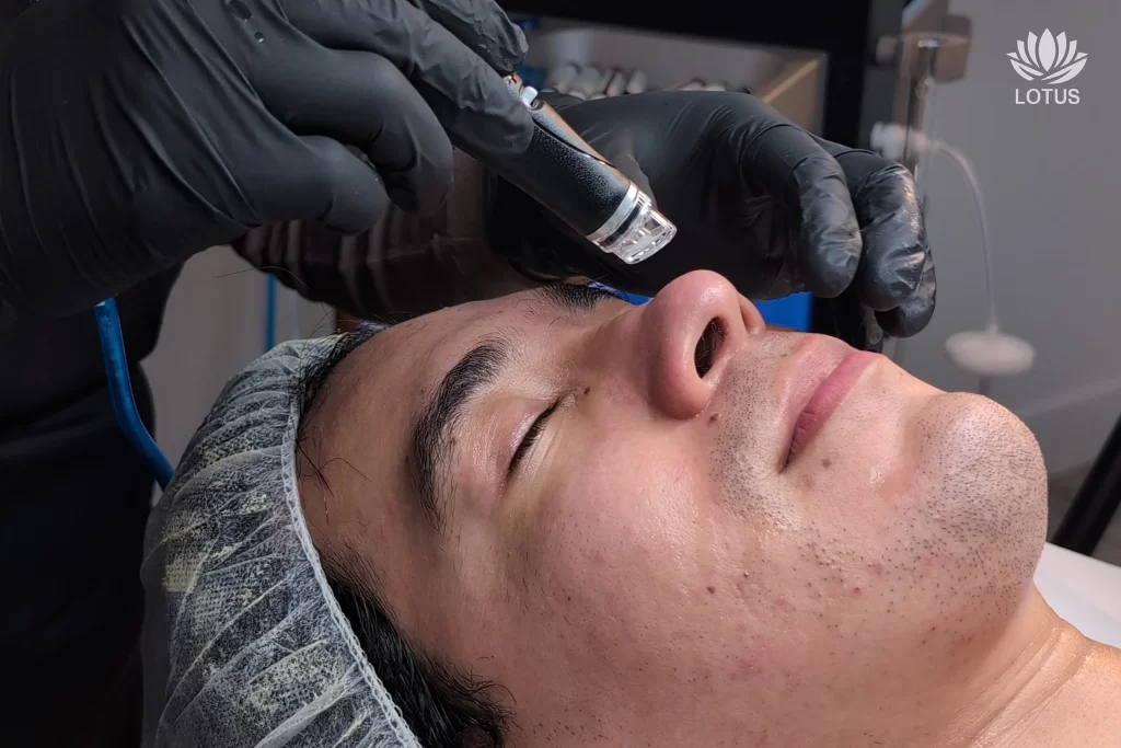 cuida tu piel antes del Torneo de fútbol / Take care of your skin before the soccer tournament