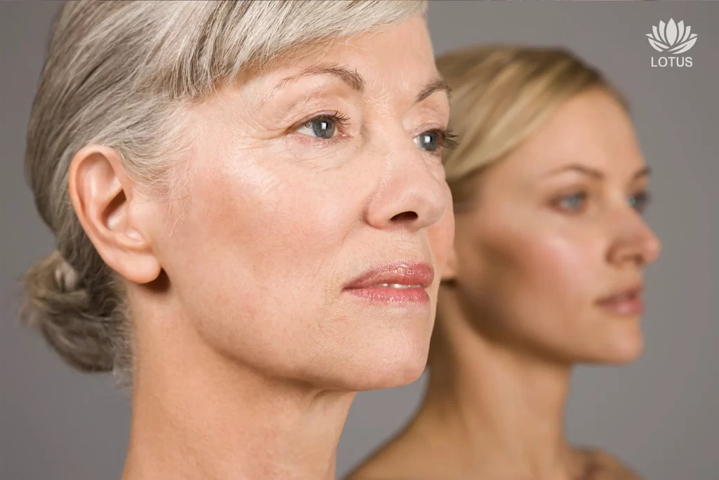 Rejuvenecimiento Facial en San Leandro: Resultados Naturales