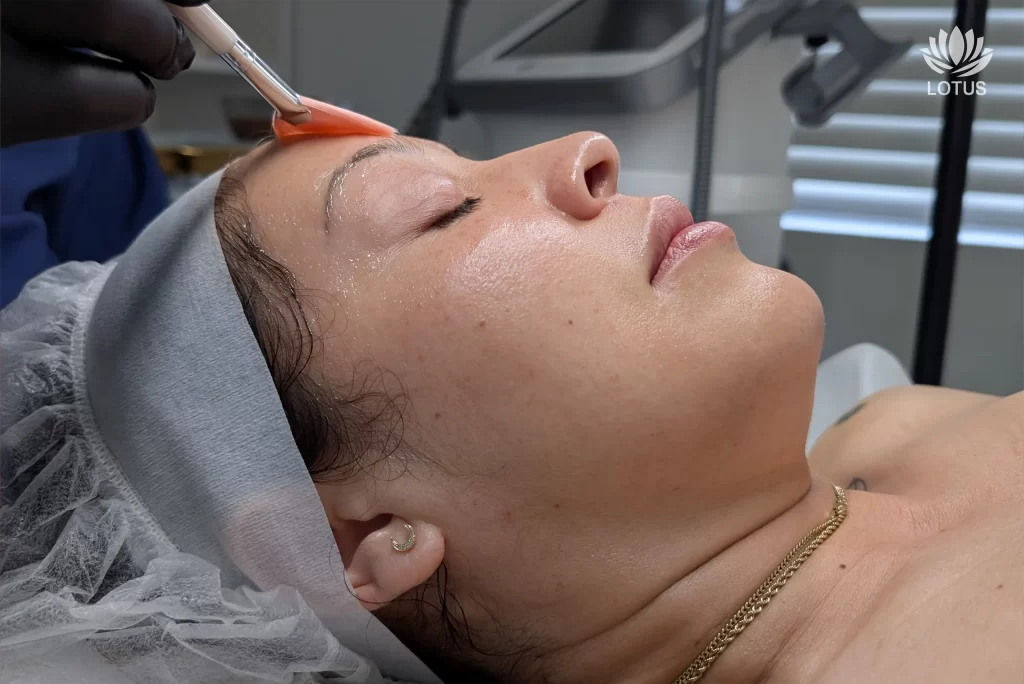 Prepara tu Piel | 4 de Julio en San Leandro | Facial de Verano // Prepare Your Skin for the 4th of July in San Leandro | Summer Facials at Lotus
