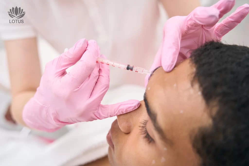 Baby Botox en San Leandro | Toxina Botulínica Preventiva en Lotus // Baby Botox in San Leandro | Preventive Botulinum Toxin at Lotus