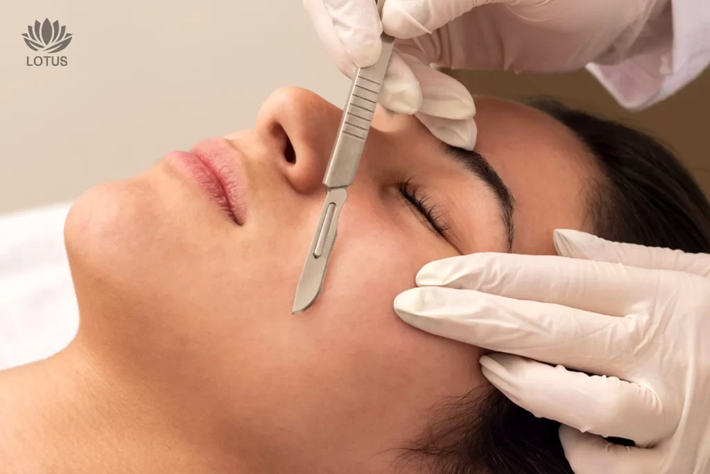 Dermaplaning en San Leandro | Exfoliación y Piel de Seda // Dermaplaning in San Leandro | Smooth Skin & Facial Exfoliating