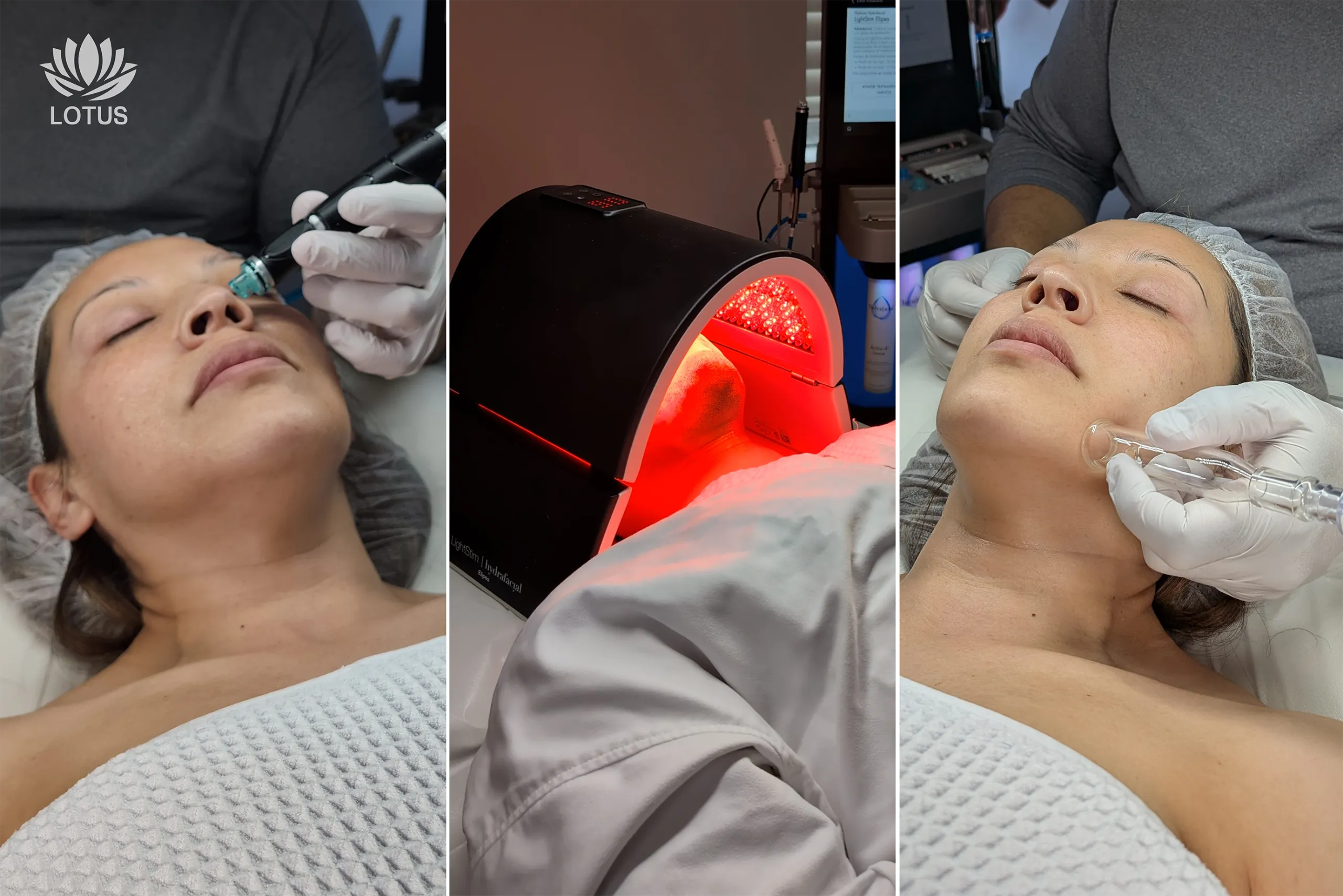 Tipos de Hydrafacials Lotus | Signature, Deluxe y Platinum // Types of Hydrafacials in Lotus | Signature, Deluxe & Platinum