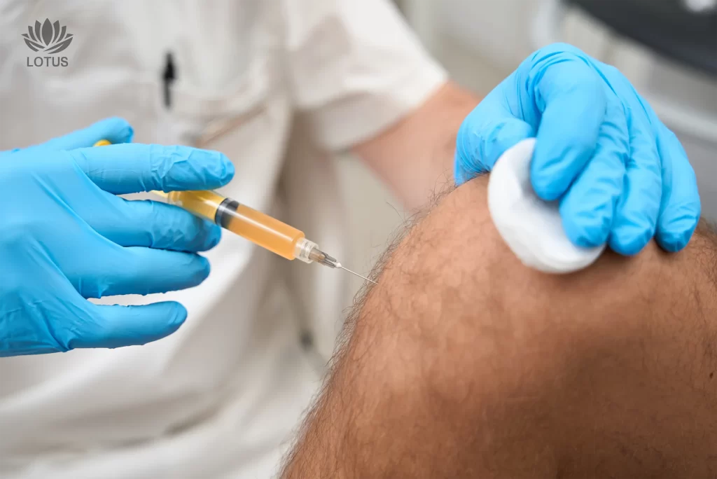 PRP para el Dolor Articular en San Leandro | Medicina Deportiva // PRP Therapy for Joint Pain in San Leandro | Sports Recovery