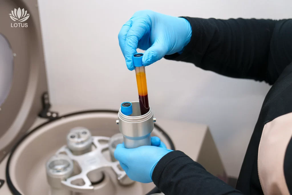 PRP para el Dolor Articular en San Leandro | Medicina Deportiva // PRP Therapy for Joint Pain in San Leandro | Sports Recovery