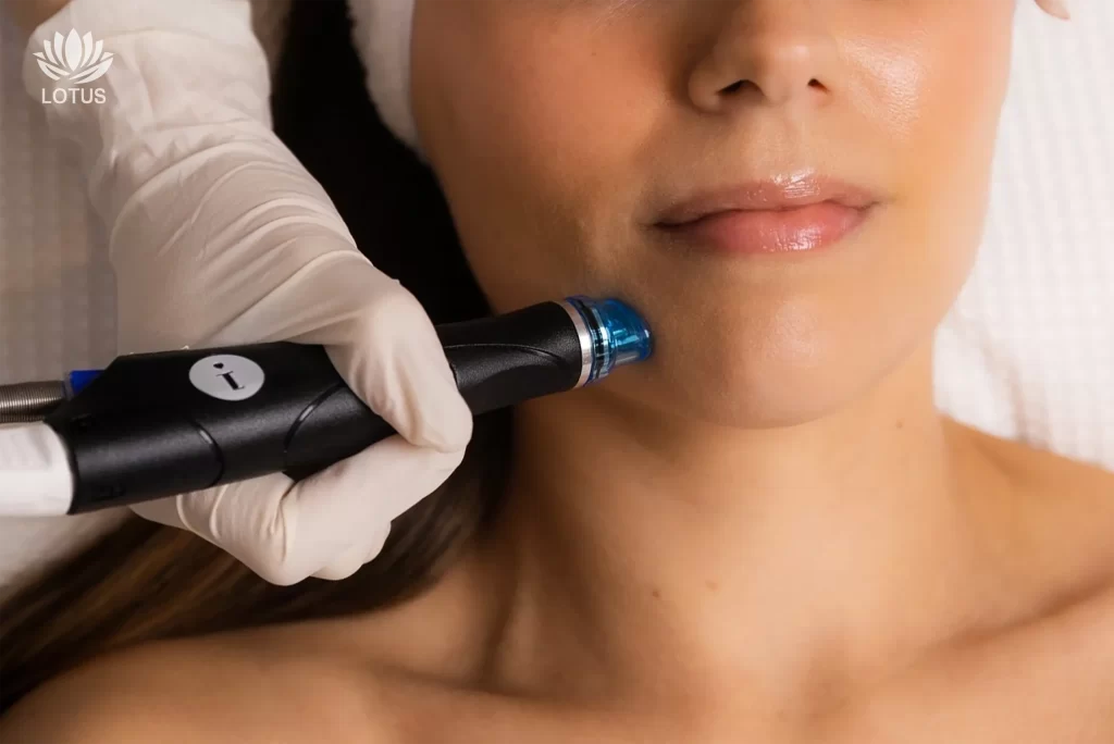 Preparar tu Piel para el Verano en San Leandro | Tratamientos Faciales //  Summer Skin Prep in San Leandro | Hydrafacial, Botox & PDRN 