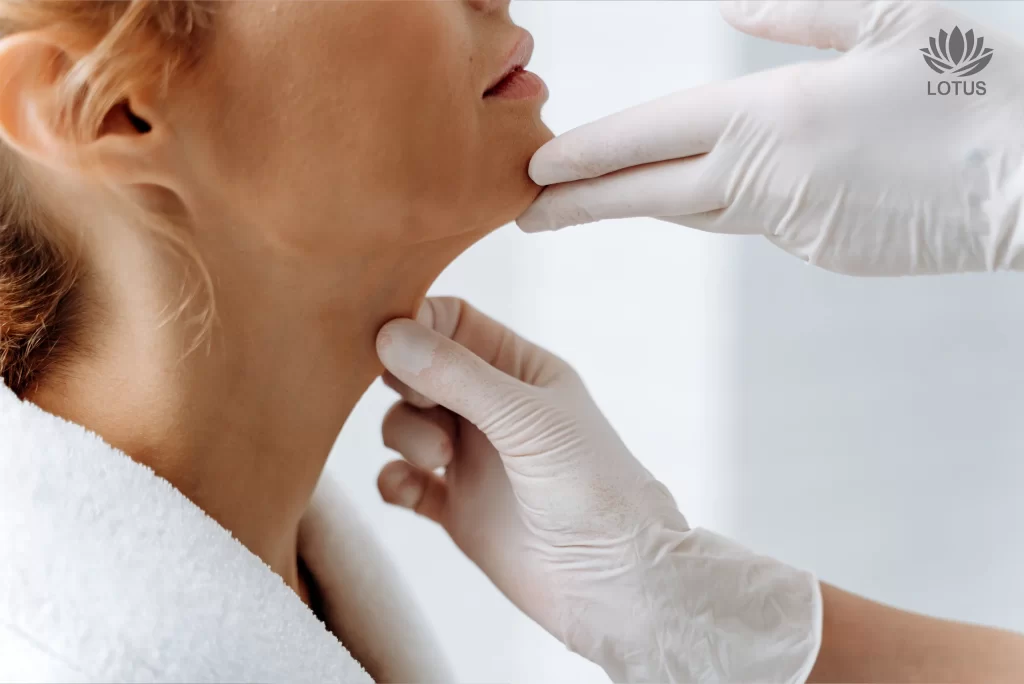 Tratamiento para el Cuello de Pavo en San Leandro // Non-Surgical Turkey Neck Treatment | Double Chin Removal